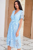 Load image into Gallery viewer, V Neck Mid Length Light Blue Lace Party Dress with Button